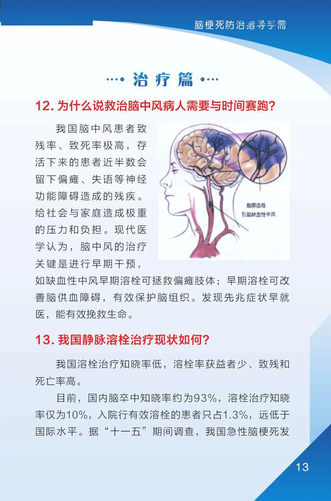 腦梗死最新指南全面解讀與應(yīng)對(duì)策略，從預(yù)防到康復(fù)的全面應(yīng)對(duì)策略
